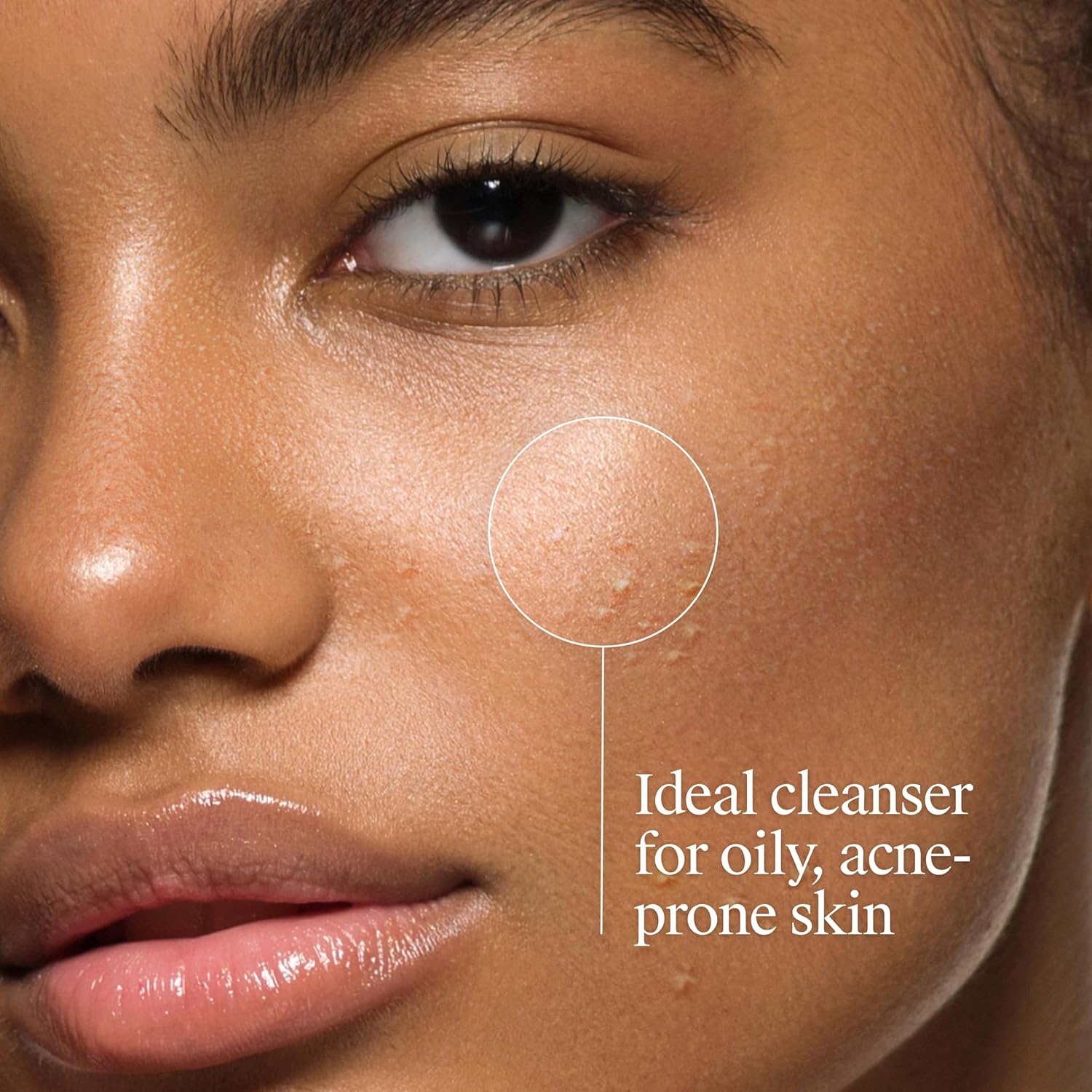 image:imageNeutrogena OilFree Acne Face Wash Facial Cleanser with Salicylic Acid Daily Cleanser for Oily amp AcneProne Skin Clears amp Helps Prevent Breakouts Clear Formula 91 fl oz Bottle