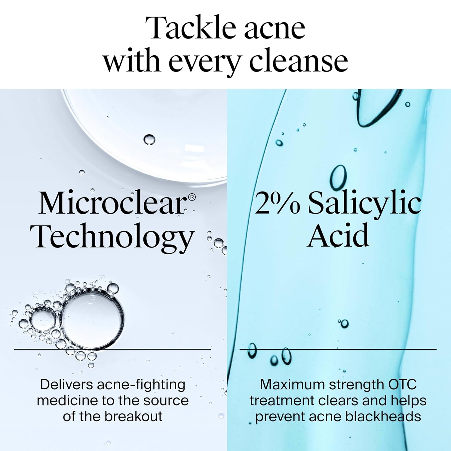 image:imageNeutrogena OilFree Acne Face Wash Facial Cleanser with Salicylic Acid Daily Cleanser for Oily amp AcneProne Skin Clears amp Helps Prevent Breakouts Clear Formula 91 fl oz Bottle