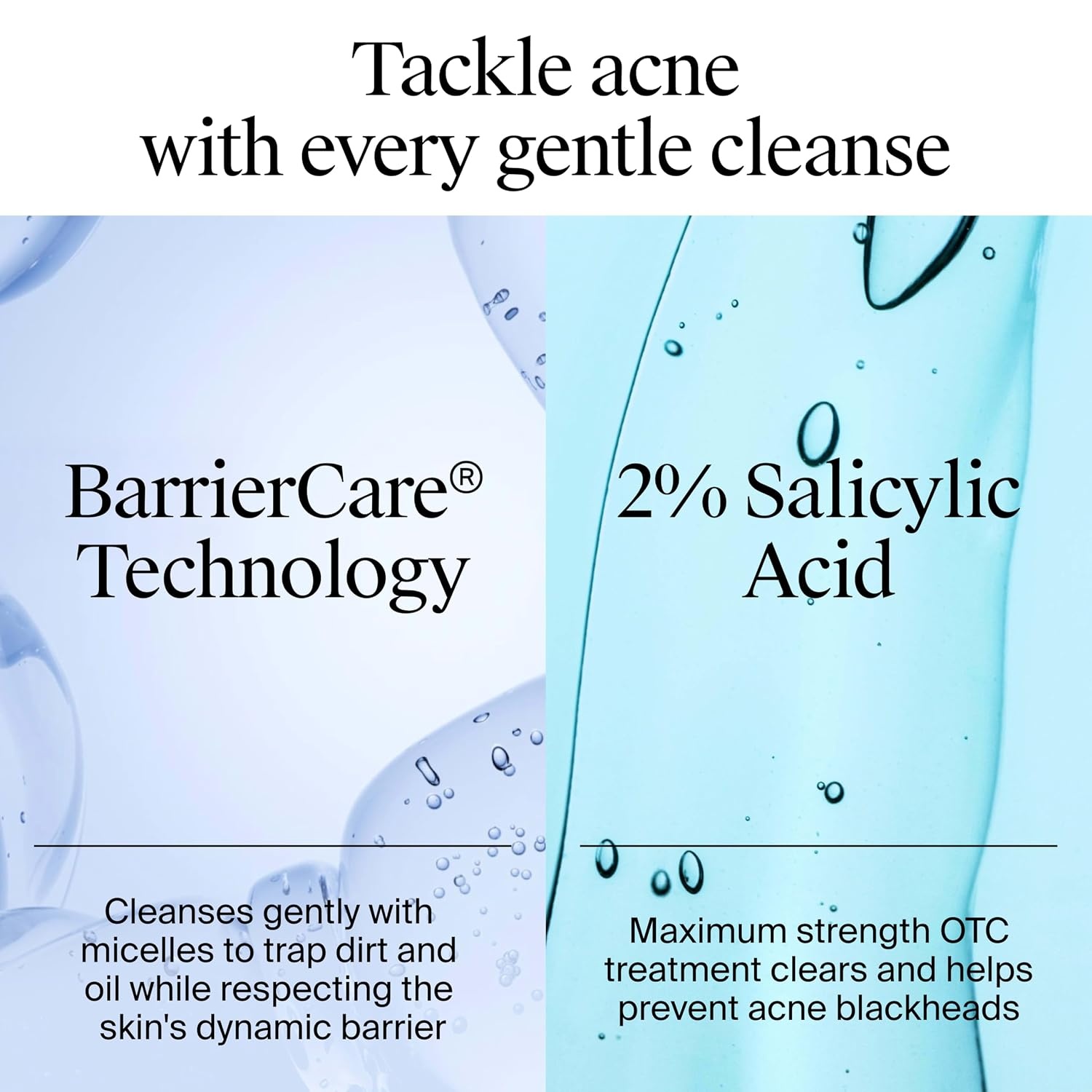 image:imageNeutrogena OilFree Acne Face Wash Fragrance Free Sensitive Skin Facial Cleanser with 2 Salicylic Acid Acne Treatment for Face 91 Fl Oz91 Fl Oz Pack of 1