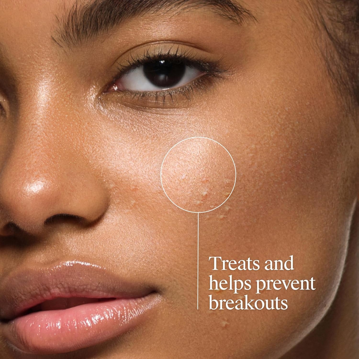 image:imageNeutrogena OilFree Acne Face Wash Fragrance Free Sensitive Skin Facial Cleanser with 2 Salicylic Acid Acne Treatment for Face 91 Fl Oz91 Fl Oz Pack of 1