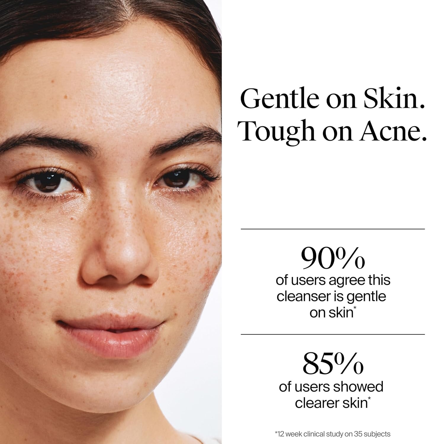 image:imageNeutrogena OilFree Acne Face Wash Fragrance Free Sensitive Skin Facial Cleanser with 2 Salicylic Acid Acne Treatment for Face 91 Fl Oz91 Fl Oz Pack of 1