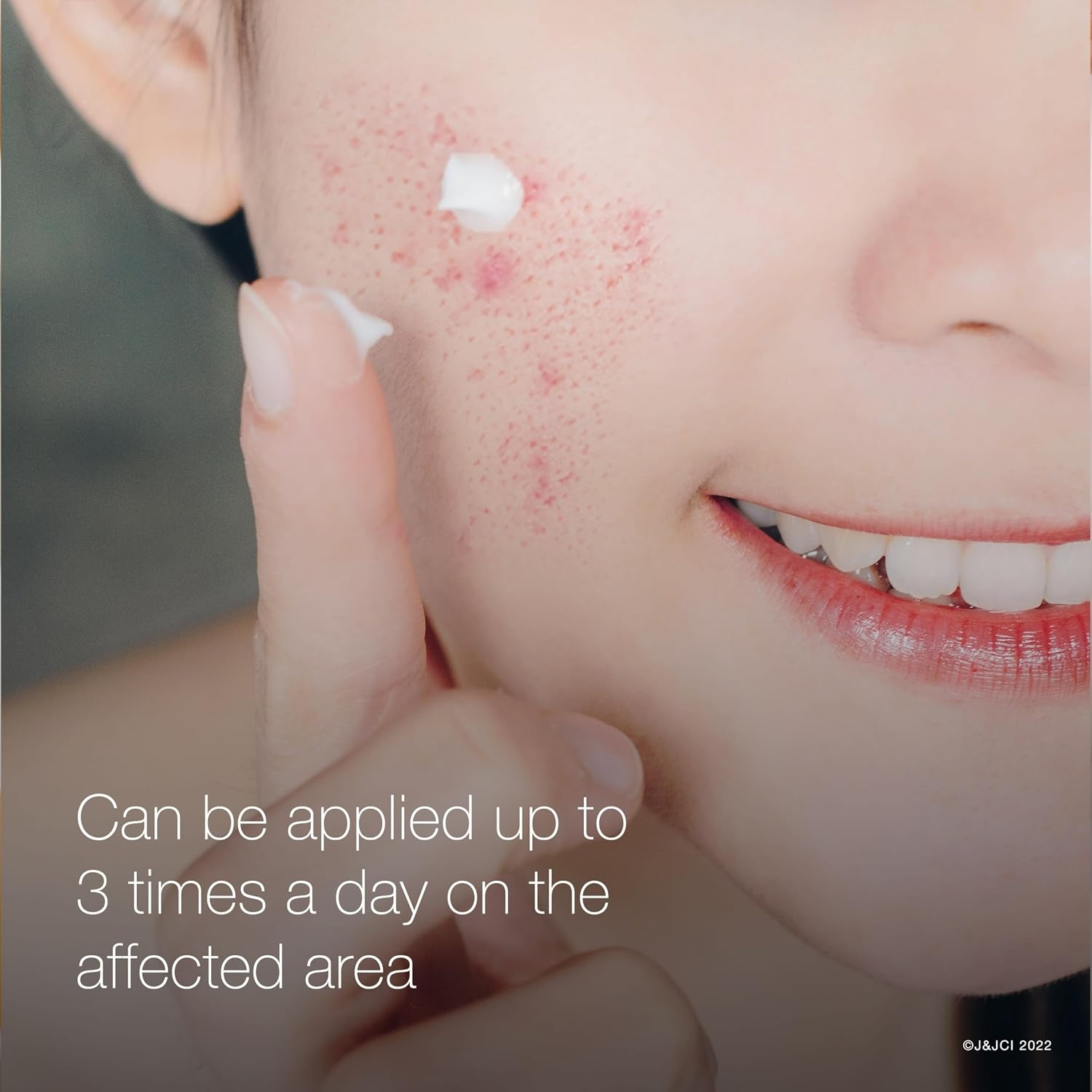 image:imageNeutrogena Rapid Clear Stubborn Acne Spot Treatment Gel with Maximum Strength 10 Benzoyl Peroxide Acne Treatment Medication Pimple Cream for Acne Prone Skin Care 1 oz 2 Pack