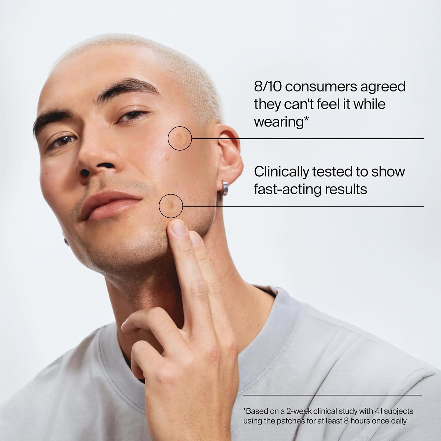 image:imageNeutrogena Stubborn Acne Patches Hydrocolloid Absorbs Impurities UltraThin Pimple Patches Work Overnight 24 ct