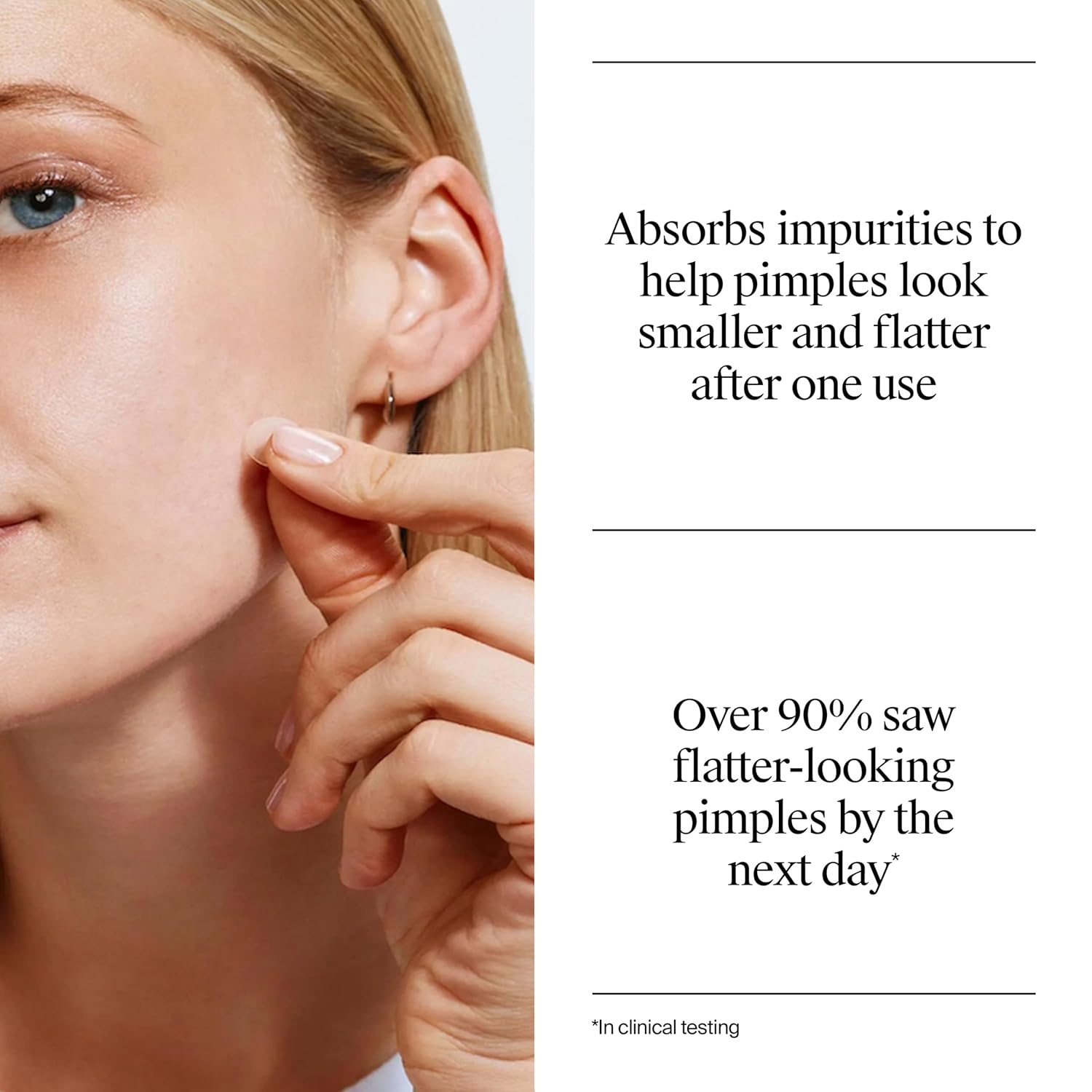 image:imageNeutrogena Stubborn Acne Patches Hydrocolloid Absorbs Impurities UltraThin Pimple Patches Work Overnight 24 ct