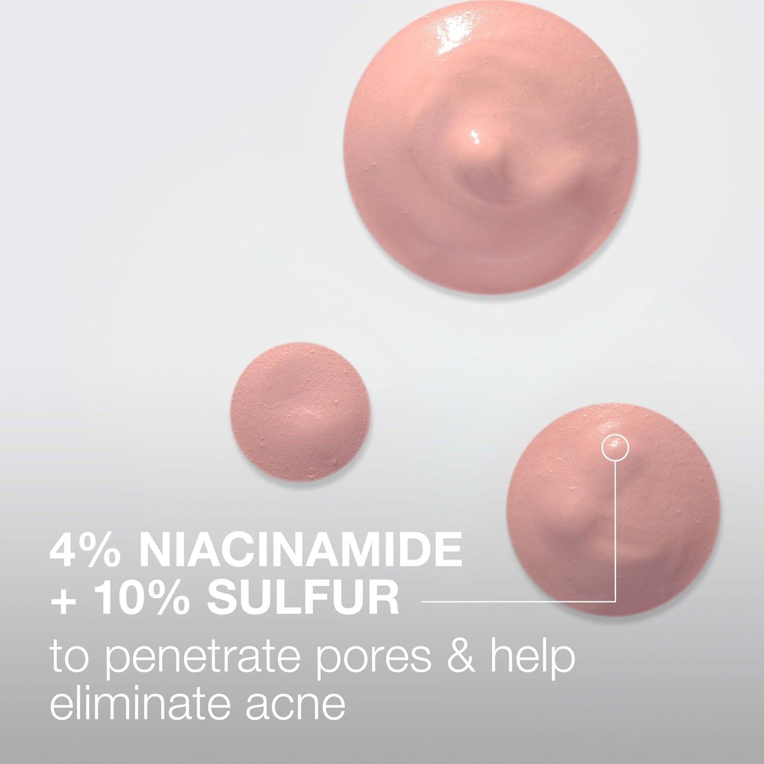 image:imageNeutrogena Stubborn Acne Spot Drying Lotion FragranceFree Sulfur Acne Treatment Clears Acne By Drying Up amp Shrinking Pimples Paraben amp OilFree 10 Sulfur amp 4 Niacinamide 10 fl oz