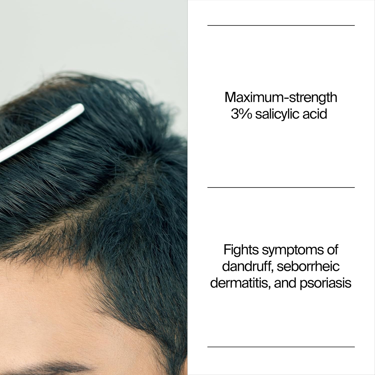 image:imageNeutrogena TSal 3 Salicylic Acid AntiDandruff Shampoo 8 fl oz