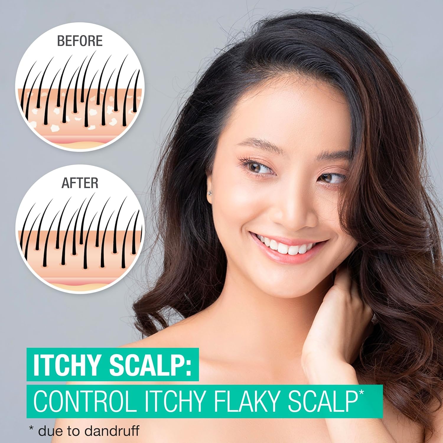 image:imageNeutrogena Scalp Therapy AntiDandruff Shampoo for Itchy Scalp 25 salicylic acid with Peppermint Fragrance 12 fl oz